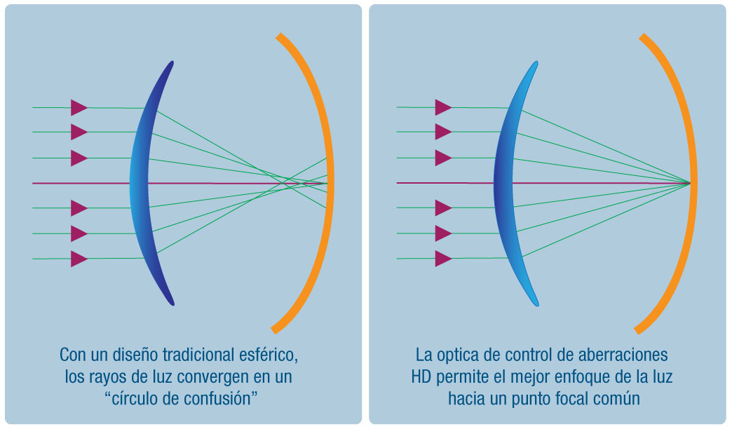 Lentes de contacto esféricos, asféricas y toricos ¡Diferencias